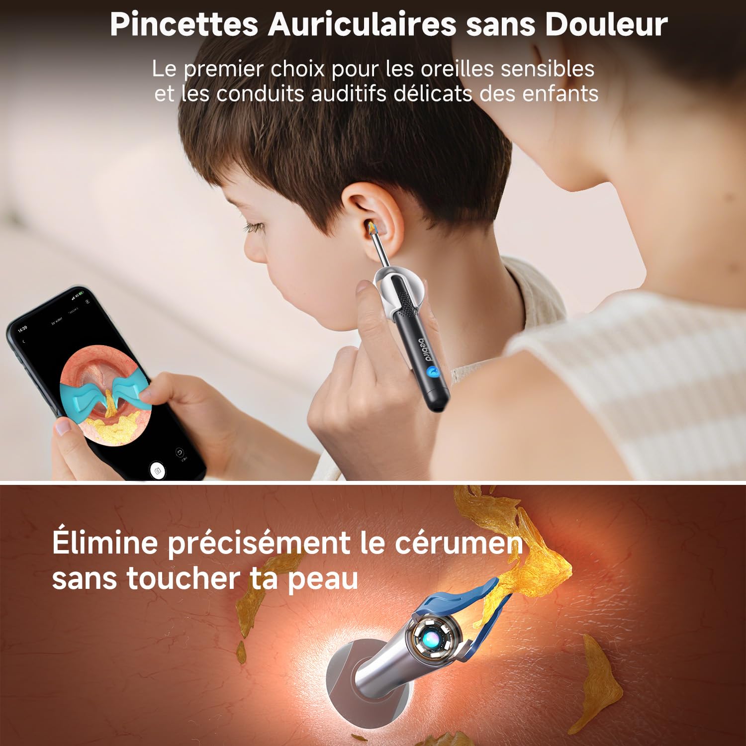 Otoscope - Kit nettoyage oreille caméra lumière USB - nettoyage précis